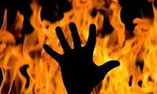 தீக்காயமடைந்த மூதாட்டி இறந்தார்