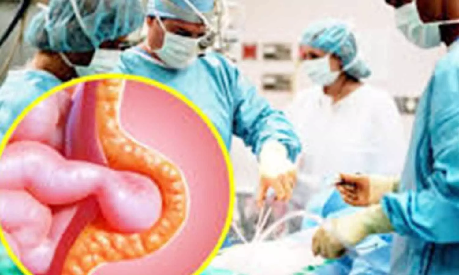 மருத்துவம் அறிவோம்- வயிற்றில் ஏற்படும் நோய்களை தடுக்க மருத்துவம் அறிவோம்- வயிற்றில் ஏற்படும் நோய்களை தடுக்க