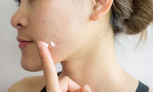 சருமத்தில் உள்ள தழும்புகளை நீக்கும் கோகோ பட்டர்