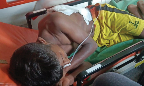 கோத்தகிரி அருகே காட்டெருமை தாக்கி மாணவர் படுகாயம்