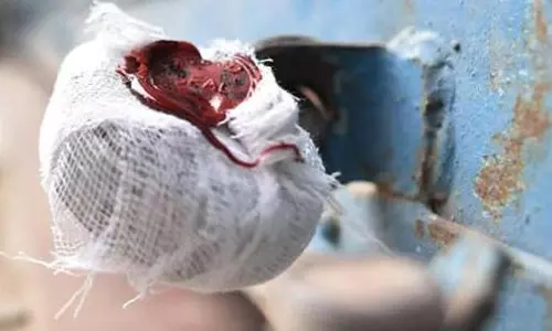 தஞ்சாவூரில் 2 பேர் பலி எதிரொலி: தமிழகம் முழுவதும் 50 சதவீத டாஸ்மாக் பார்கள் சீல் வைப்பு