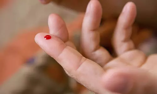 ரத்தம் உறையாமை நோய்க்கான அறிகுறிகள்