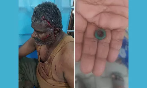 வேலூர் அரசு ஆஸ்பத்திரியில் அலட்சியம்- டிரைவர் தலையில் நட்டு வைத்து தையல்