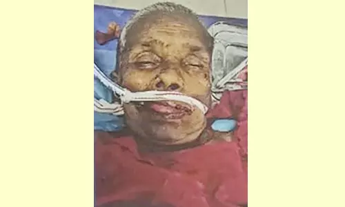 வாகனம் மோதி மூதாட்டி-முதியவர் பலி