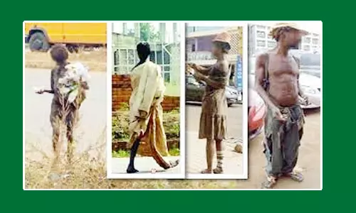 வீதியில் சுற்றித்திரியும் மனநலம் பாதித்த நோயாளிகள்