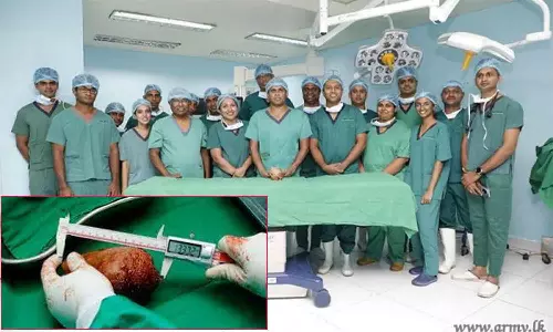 உலகின் மிகப்பெரிய சிறுநீரக கல்லை அகற்றி இலங்கை ராணுவ மருத்துவர்கள் உலக சாதனை