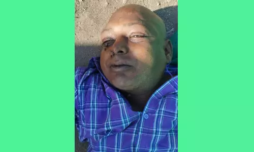 முகத்தில் காயத்துடன் இறந்து கிடந்த வாலிபர்