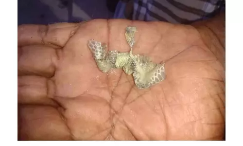 குடிநீர் குழாயில் இருந்து வந்த பாம்பு தோல்