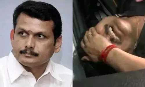 அமைச்சர் செந்தில் பாலாஜிக்கு இருதய அறுவை சிகிச்சை தொடங்கியது