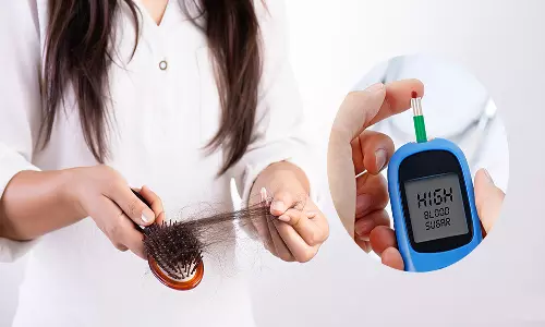 நீரிழிவு நோயாளிகளுக்கு முடி உதிர்வு அதிகமாக இருக்குமா?