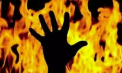 மகளை மிரட்டுவதற்காக தீக்குளிப்பது போன்று மிரட்டிய தாய் மீது தீப்பிடித்தது