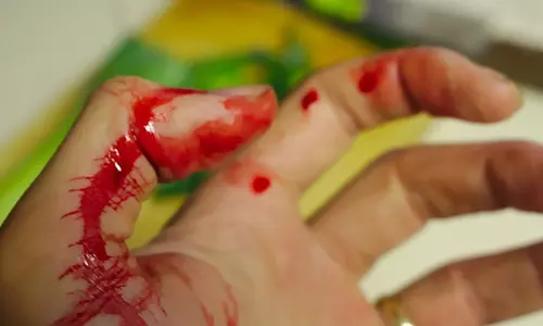 வேன் மீது கார் மோதியதில் வாலிபர் காயம்