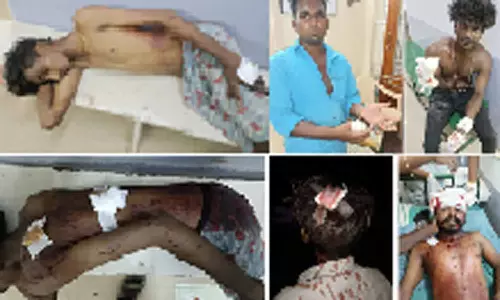 திசையன்விளையில் கோஷ்டி மோதலில் 5 பேருக்கு அரிவாள் வெட்டு- மேலும் 4 பேர் படுகாயம்