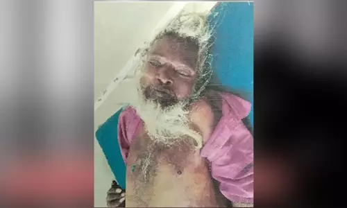 சேலத்தில் மயங்கி கிடந்த முதியவர் சிகிச்சை பலனின்றி சாவு