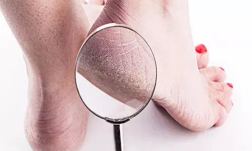 நீர்ச்சத்து குறைவும்... பாத வெடிப்பும்...!