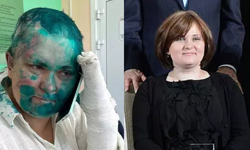 பத்திரிகையாளர் மீது மிருகவெறி தாக்குதல்: செச்சென்யாவில் கொடூரம்