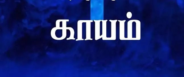 நத்தம் அருகே காட்டுமாடு முட்டியதில் வியாபாரி காயம்