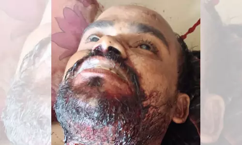 ஓட்டல் தொழிலாளி கழுத்தை அறுத்து தற்கொலை