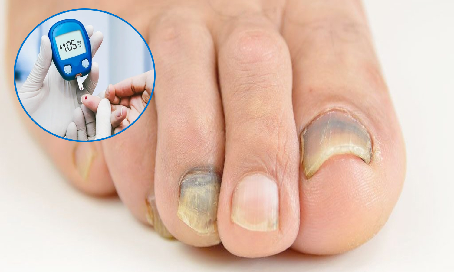 What Causes Nails To Turn Black