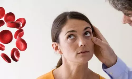 ரத்த சோகைக்கு தீர்வு