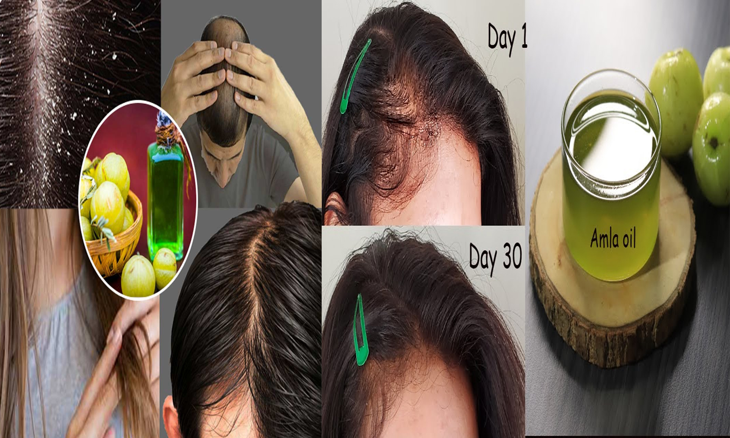 கூந்தல் பிரச்சனைகளை தீர்க்க நெல்லிக்காயை எப்படி பயன்படுத்தலாம்...