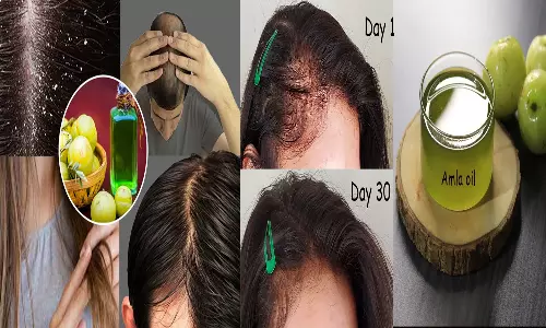 கூந்தல் பிரச்சனைகளை தீர்க்க நெல்லிக்காயை எப்படி பயன்படுத்தலாம்...