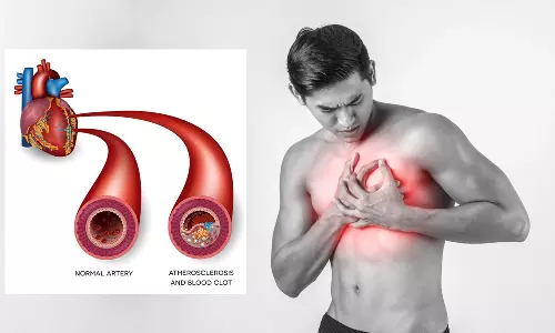 இதயத்திற்கு ரத்தம் எடுத்துச்செல்லும் குழாய்களில் மட்டும் அடைப்பு ஏற்படுவது ஏன்?