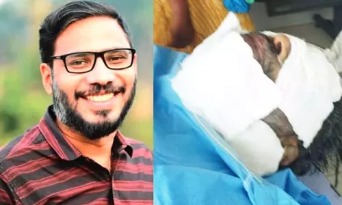 திருவனந்தபுரம் அருகே வீடு புகுந்து கம்யூனிஸ்ட் நிர்வாகி மீது ஆசிட் வீச்சு