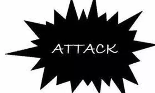 கோவையில் கல்லூரி மாணவியை நடுரோட்டில் தாக்கிய வாலிபர்