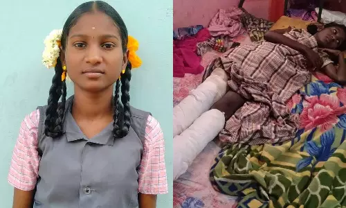 ஆண்டிபட்டியில் அரசு விளம்பர சுவர் இடிந்து 2 கால்களை இழந்த மாணவி