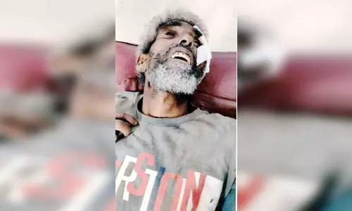 இருசக்கர வாகனம் மோதி மனநலம் பாதித்தவர் பலி