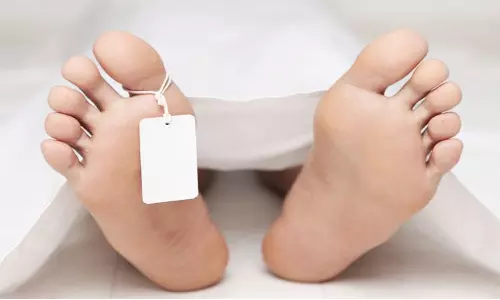 மரத்திலிருந்து தவறி கீழே விழுந்தவர் சாவு