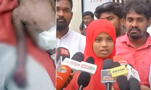 எழும்பூர் அரசு மருத்துவமனையில் கை அகற்றப்பட்ட குழந்தை உயிரிழப்பு