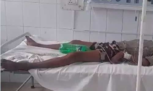 சிறுநீர் பைக்கு பதிலாக ஸ்ப்ரைட் பாட்டில் பொருத்தம் - அதிர்ச்சி அளித்த பீகார் மருத்துவமனை