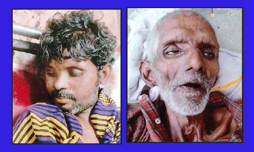 அடையாளம் தெரியாத ஆண் பிணங்கள்