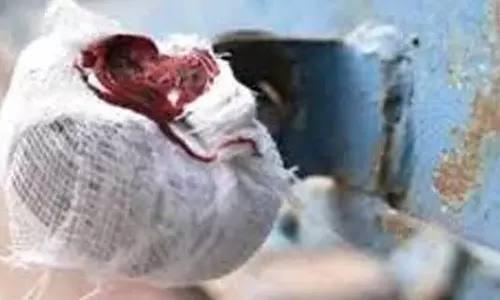 நோயாளிகளுக்கு சிகிச்சை அளித்த மருந்து கடைக்கு சீல்