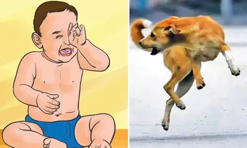 நாய் கடித்ததில் குழந்தை படுகாயம்