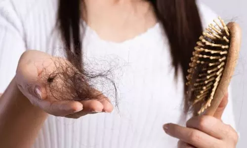 முடி உதிர்தல் பிரச்சினையில் இருந்து விடுபடுவது எப்படி?