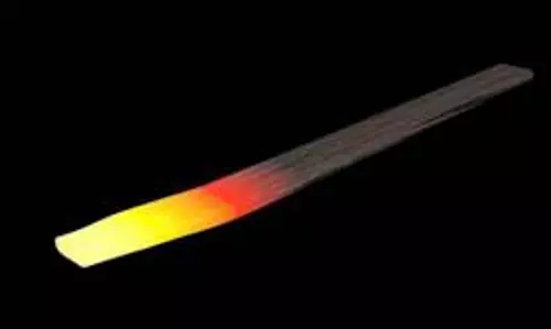 மகள்-மகனுக்கு தோசை கரண்டியால் சூடு