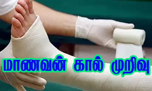 மாடியில் இருந்து தவறி விழுந்த மாணவன் கால் முறிவு