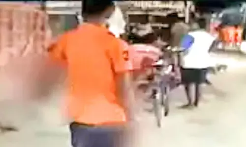 துண்டான கையை மற்றொரு கையில் எடுத்து சென்ற வாலிபர்