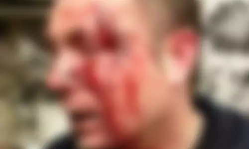 மது பாட்டிலால் வாலிபர் மண்டை உடைப்பு