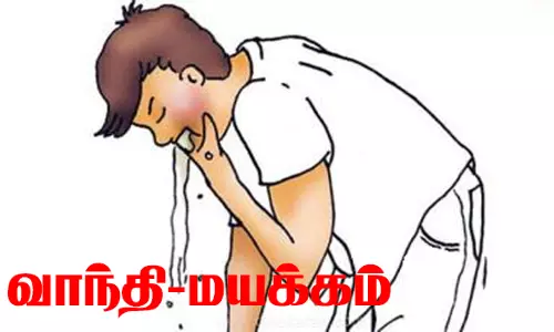 நாமக்கல்லில் தனியார் உணவகத்தில் சாப்பிட்டமருத்துவ கல்லூரி மாணவர்கள் 13 பேருக்கு வாந்தி-மயக்கம்