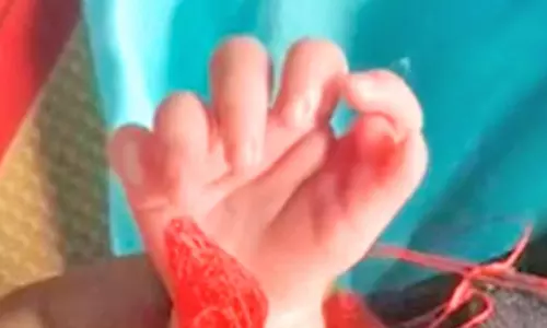 ராஜஸ்தானில் 26 விரல்களுடன் பிறந்த குழந்தை- தேவியின் அவதாரம் என குடும்பத்தினர் மகிழ்ச்சி