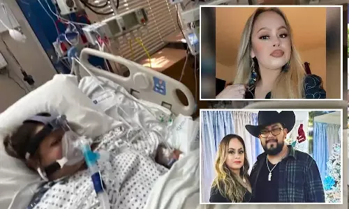 மீன் சாப்பிட்டதால் கை, கால்களை இழந்த கலிபோர்னிய பெண்