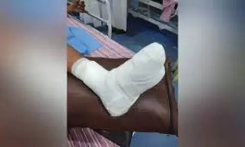 பஸ் படிகட்டில் பயணம் செய்த பள்ளி மாணவன் தவறி விழுந்து கால் விரல்கள் துண்டானது