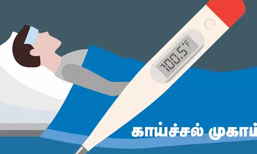 சேலம் மாவட்டத்தில் நாளை முதல்காய்ச்சல் பரவலை தடுக்க75 சிறப்பு மருத்துவ  முகாம்கள்