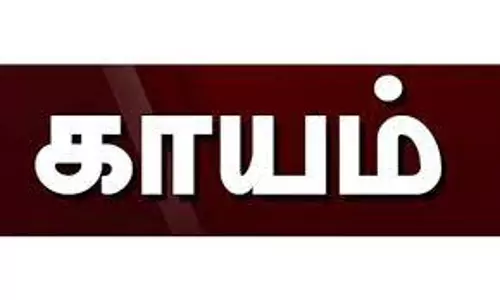 பேட்டரி வெடித்து 2 மாணவர்கள் காயம்