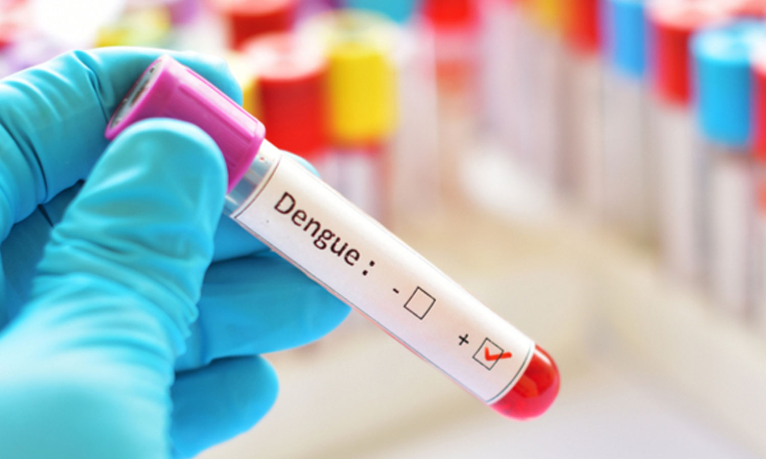 புதுக்கோட்டையில் மேலும் 3 பேருக்கு டெங்கு காய்ச்சல்: பாதிக்கப்பட்ட 137 பேருக்கு சிகிச்சை