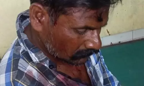 வேட்டைக்கு சென்றவர்கள் மீது தாக்குதல்